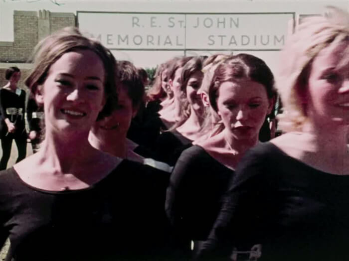 beauty knows no pain